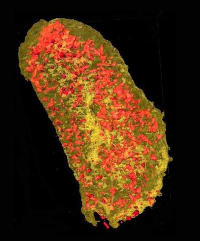 Ultrabright X-rays revealed the concentration of erbium