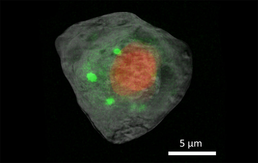X-ray imaging of a human embryonic kidney cell